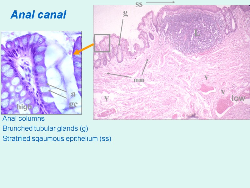 Anal canal Anal columns Brunched tubular glands (g) Stratified sqaumous epithelium (ss) ig g